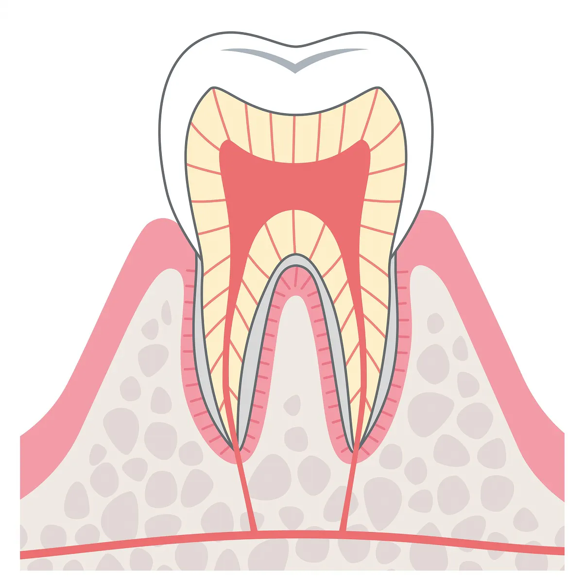 むし歯の進行と治療方法